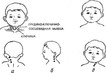 Шиацу — японская терапия надавливанием пальцами