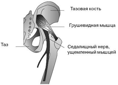 Заболевания простаты операция