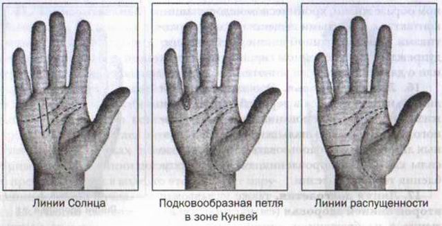 Лечение и диагноз по ладони