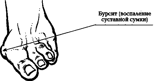 Евдокименко. Артроз. Избавляемся от боли в суставах