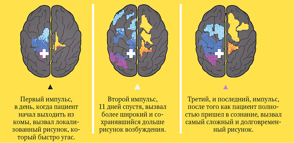 Мозг: Ваша личная история
