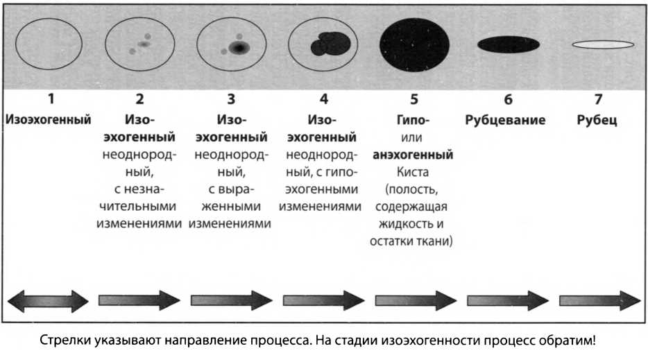 Восстановление щитовидной железы