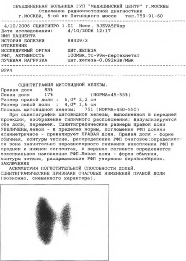 Восстановление щитовидной железы