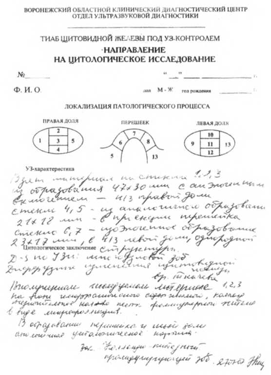 Восстановление щитовидной железы